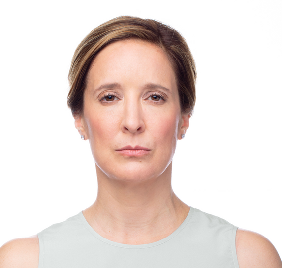 Before Vitalithe - Male