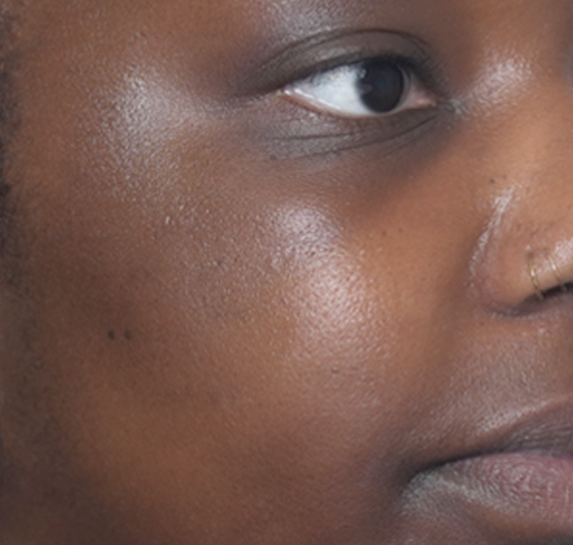 Before Vitalithe - Female