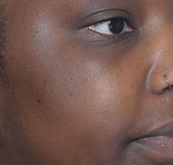 After Vitalithe - Female